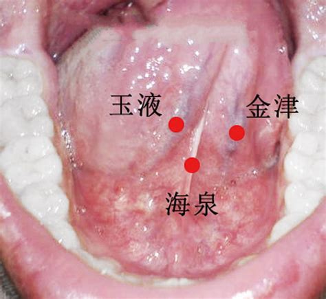 小穴位置